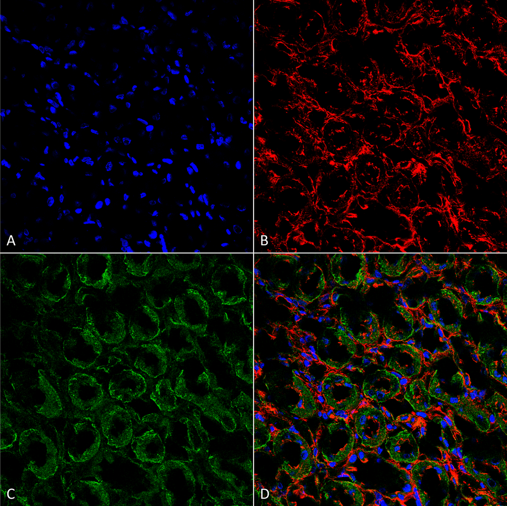 <p>Immunohistochemistry analysis using Rabbit Anti-ENaC Polyclonal Antibody (SPC-403). Tissue: kidney tissue. Species: Rat. Fixation: Formalin Fixed Paraffin-Embedded. Primary Antibody: Rabbit Anti-ENaC Polyclonal Antibody (SPC-403) at 1:25 for 1 hour at RT. Secondary Antibody: Goat Anti-Rabbit IgG: Alexa Fluor 488. Counterstain: Actin-binding Phalloidin-Alexa Fluor 633; DAPI (blue) nuclear stain. Magnification: 63X. (A) DAPI (blue) nuclear stain. (B) Phalloidin Alex Fluor 633 F-Actin stain. (C)ENaC Antibody (D) Composite</p>
