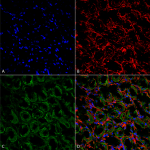 SPC-403_ENaC_Antibody_IHC_Rat_kidney-tissue_63X_1.png