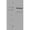 Rabbit Anti-ENaC Antibody used in Western blot (WB) on kidney tissue lysates (SPC-403)