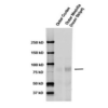 Rabbit Anti-ENaC Antibody used in Western blot (WB) on kidney tissue lysates (SPC-403)