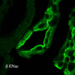 SPC-404_ENaC_Antibody_IHC_Rat_kidney-tissue_1.png