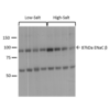 Rabbit Anti-ENaC Antibody used in Western blot (WB) on kidney cortex (SPC-404)