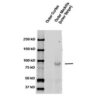 Rabbit Anti-ENaC Antibody used in Western blot (WB) on kidney tissue lysates (SPC-404)