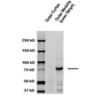 Rabbit Anti-ENaC Antibody used in Western blot (WB) on kidney tissue lysates (SPC-405)