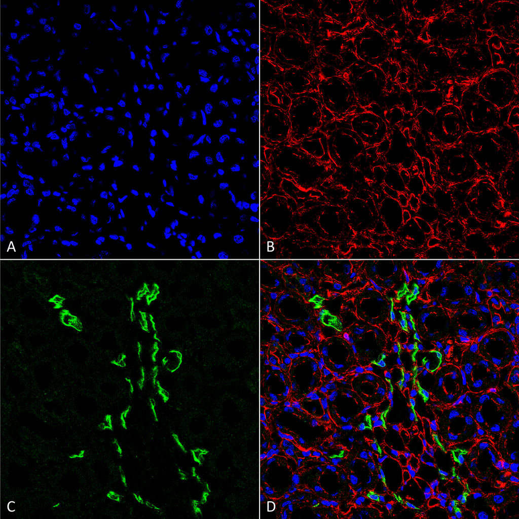 <p>Immunohistochemistry analysis using Rabbit Anti-UT-A1 Polyclonal Antibody (SPC-406). Tissue: kidney tissue. Species: Rat. Fixation: Formalin Fixed Paraffin-Embedded. Primary Antibody: Rabbit Anti-UT-A1 Polyclonal Antibody (SPC-406) at 1:25 for 1 hour at RT. Secondary Antibody: Goat Anti-Rabbit IgG: Alexa Fluor 488. Counterstain: Actin-binding Phalloidin-Alexa Fluor 633; DAPI (blue) nuclear stain. Magnification: 63X. (A) DAPI (blue) nuclear stain. (B) Phalloidin Alex Fluor 633 F-Actin stain. (C)UT-A1 Antibody (D) Composite</p>
