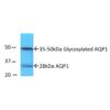 Rabbit Anti-Aquaporin 1 Antibody used in Western blot (WB) on kidney inner medullary homogenates (SPC-502)