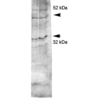 Rabbit Anti-Aquaporin 4 Antibody used in Western blot (WB) on kidney inner medullary homogenates (SPC-505)