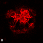 SPC-506-Amyloid-Oligomers-A11-Antibody-IHC-Human-Alzheimer’s-Disease-brain-1.png