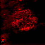 SPC-507-Amyloid-Fibrils-OC-Antibody-IHC-Human-Alzheimer’s-Disease-brain-1.png