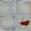 Rabbit Anti-Amyloid Fibrils (OC) Antibody used in Immunohistochemistry (IHC) on Alzheimer's Disease brain (SPC-507)