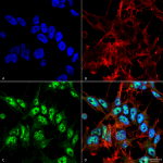 SPC-600-Beclin-1-Antibody-ICC-IF-Human-Neuroblastoma-cell-line-SK-N-BE-60X-Composite-1.png