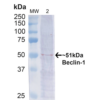 Rabbit Anti-Beclin 1 Antibody used in Western blot (WB) on Cervical cancer cell line (HeLa) lysate (SPC-600)