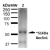 Rabbit Anti-Beclin 1 Antibody used in Western blot (WB) on Liver (SPC-600)