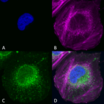 SPC-601_Beclin-1_Antibody_ICC-IF_Human_SK-N-BE_1.png