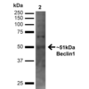 Rabbit Anti-Beclin 1 Antibody used in Western blot (WB) on Embryonic kidney epithelial cell line (HEK293T) lysate (SPC-601)