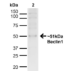 Rabbit Anti-Beclin 1 Antibody used in Western blot (WB) on Cervical cancer cell line (HeLa) lysate (SPC-601)