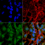 SPC-606-UVRAG-Antibody-ICC-IF-Human-Neuroblastoma-cell-line-SK-N-BE-60X-Composite-1.png