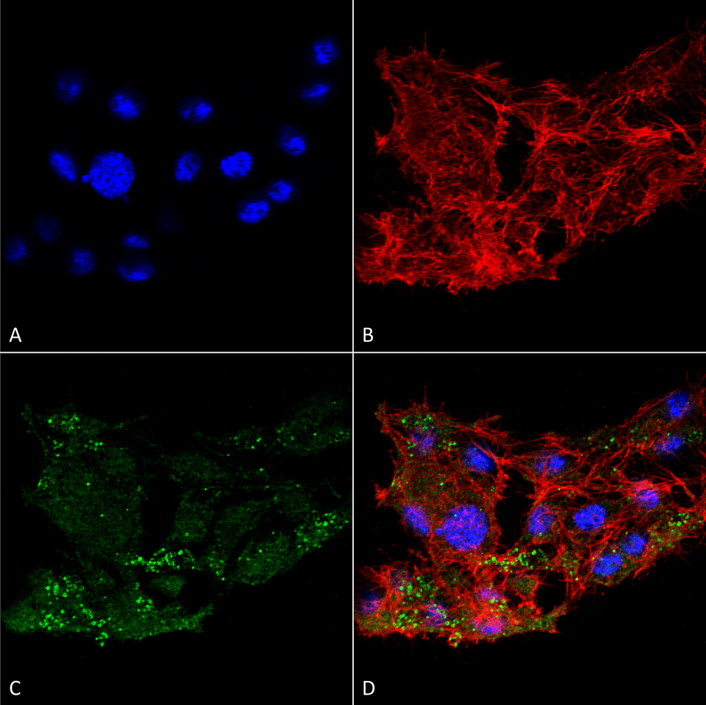 <p>Immunocytochemistry/Immunofluorescence analysis using Rabbit Anti-ATG7 Polyclonal Antibody (SPC-610). Tissue: Colon carcinoma cell line (RKO). Species: Human. Fixation: 4% Formaldehyde for 15 min at RT. Primary Antibody: Rabbit Anti-ATG7 Polyclonal Antibody (SPC-610) at 1:100 for 60 min at RT. Secondary Antibody: Goat Anti-Rabbit ATTO 488 at 1:100 for 60 min at RT. Counterstain: Phalloidin Texas Red F-Actin stain; DAPI (blue) nuclear stain at 1:1000, 1:5000 for 60 min at RT, 5 min at RT. Localization: Cytoplasm, Preautophagosomal Structure, Organelle membrane. Magnification: 60X. (A) DAPI nuclear stain. (B) Phalloidin Texas Red F-Actin stain. (C) ATG7 Antibody. (D) Composite.</p>
