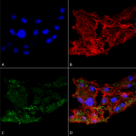SPC-610_ATG7_Antibody_ICC-IF_Human_Colon-carcinoma-cell-line-RKO_60X_Composite_1.png