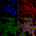 SPC-620-GABARAP-Antibody-ICC-IF-Human-Neuroblastoma-cell-line-SK-N-BE-60X-Composite-1.png
