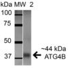 Rabbit Anti-ATG4B Antibody used in Western blot (WB) on Brain cell lysates (SPC-630)