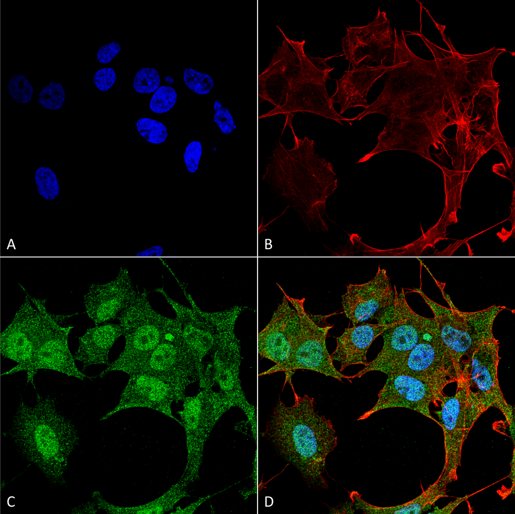<p>Immunocytochemistry/Immunofluorescence analysis using Rabbit Anti-ATG4B Polyclonal Antibody (SPC-630). Tissue: Neuroblastoma cell line (SK-N-BE). Species: Human. Fixation: 4% Formaldehyde for 15 min at RT. Primary Antibody: Rabbit Anti-ATG4B Polyclonal Antibody (SPC-630) at 1:100 for 60 min at RT. Secondary Antibody: Goat Anti-Rabbit ATTO 488 at 1:200 for 60 min at RT. Counterstain: Phalloidin Texas Red F-Actin stain; DAPI (blue) nuclear stain at 1:1000, 1:5000 for 60 min at RT, 5 min at RT. Localization: Cytoplasm, Nucleus. Magnification: 60X. (A) DAPI (blue) nuclear stain (B) Phalloidin Texas Red F-Actin stain (C) ATG4B Antibody (D) Composite.</p>
