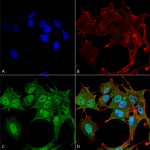SPC-630_ATG4B_Antibody_ICC-IF_Human_SK-N-BE-Cells-Human-Neuroblastoma-cells_60X_Composite_1.png