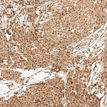 SPC-638_FUNDC1_Antibody_IHC_Human_Brain_10X_1.png