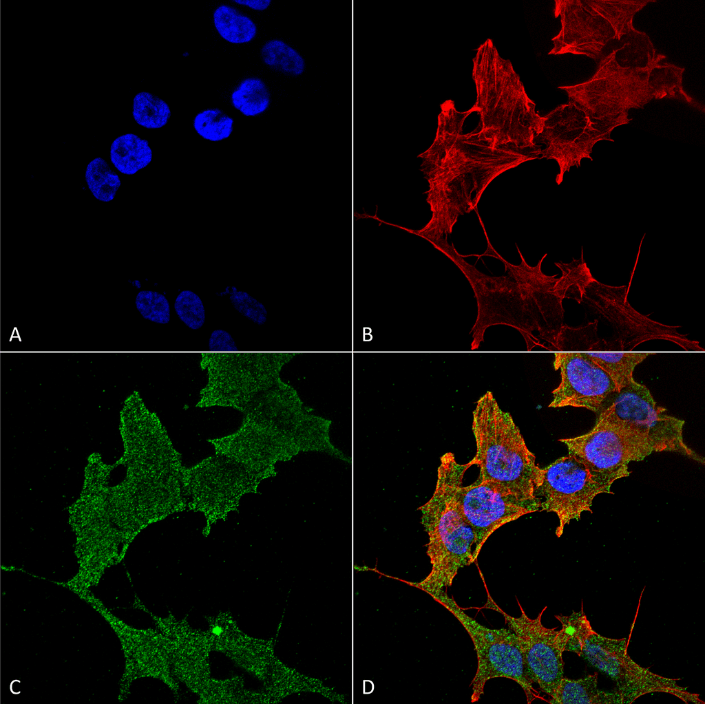 <p>Immunocytochemistry/Immunofluorescence analysis using Rabbit Anti-ULK1 Polyclonal Antibody (SPC-640). Tissue: Neuroblastoma cell line (SK-N-BE). Species: Human. Fixation: 4% Formaldehyde for 15 min at RT. Primary Antibody: Rabbit Anti-ULK1 Polyclonal Antibody (SPC-640) at 1:100 for 60 min at RT. Secondary Antibody: Goat Anti-Rabbit ATTO 488 at 1:200 for 60 min at RT. Counterstain: Phalloidin Texas Red F-Actin stain; DAPI (blue) nuclear stain at 1:1000, 1:5000 for 60 min at RT, 5 min at RT. Localization: Cytoplasm, Preautophagosomal Structure. Magnification: 60X. (A) DAPI (blue) nuclear stain (B) Phalloidin Texas Red F-Actin stain (C) ULK1 Antibody (D) Composite.</p>
