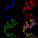 SPC-640_ULK1_Antibody_ICC-IF_Human_SK-N-BE-Cells-Human-Neuroblastoma-cells_60X_Composite_1.png