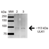 Rabbit Anti-ULK1 Antibody used in Western blot (WB) on HeLa and HEK293Trap cell lysates (SPC-640)
