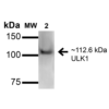 Rabbit Anti-ULK1 Antibody used in Western blot (WB) on kidney lysates (SPC-640)