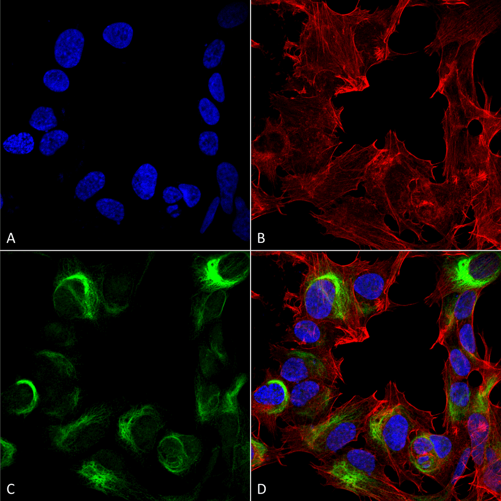 <p>Immunocytochemistry/Immunofluorescence analysis using Rabbit Anti-AMBRA1 Polyclonal Antibody (SPC-644). Tissue: Neuroblastoma cell line (SK-N-BE). Species: Human. Fixation: 4% Formaldehyde for 15 min at RT. Primary Antibody: Rabbit Anti-AMBRA1 Polyclonal Antibody (SPC-644) at 1:100 for 60 min at RT. Secondary Antibody: Goat Anti-Rabbit ATTO 488 at 1:200 for 60 min at RT. Counterstain: Phalloidin Texas Red F-Actin stain; DAPI (blue) nuclear stain at 1:1000, 1:5000 for 60 min at RT, 5 min at RT. Localization: Cytoplasmic Vesicle, Autophagosome. Magnification: 60X. (A) DAPI (blue) nuclear stain (B) Phalloidin Texas Red F-Actin stain (C) AMBRA1 Antibody (D) Composite.</p>
