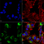 SPC-644_AMBRA1_Antibody_ICC-IF_Human_SK-N-BE-Cells-Human-Neuroblastoma-cells_60X_Composite_1.png