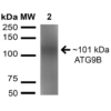 Rabbit Anti-ATG9B Antibody used in Western blot (WB) on Brain cell lysates (SPC-646)