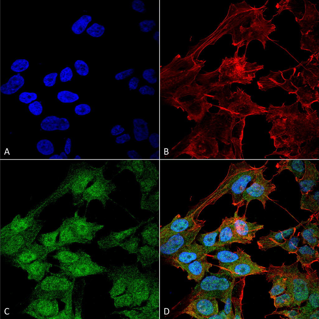 <p>Immunocytochemistry/Immunofluorescence analysis using Rabbit Anti-ATG9B Polyclonal Antibody (SPC-646). Tissue: Neuroblastoma cell line (SK-N-BE). Species: Human. Fixation: 4% Formaldehyde for 15 min at RT. Primary Antibody: Rabbit Anti-ATG9B Polyclonal Antibody (SPC-646) at 1:100 for 60 min at RT. Secondary Antibody: Goat Anti-Rabbit IgG: Alexa Fluor 488 at 1:200 for 60 min at RT. Counterstain: Phalloidin Texas Red F-Actin stain; DAPI (blue) nuclear stain at 1:1000, 1:5000 for 60 min at RT, 5 min at RT. Localization: Cytoplasmic Vesicle, Autophagosome Membrane, Multi-Pass Membrane Protein. Magnification: 60X. (A) DAPI (blue) nuclear stain (B) Phalloidin Texas Red F-Actin stain (C) ATG9B Antibody (D) Composite.</p>
