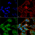SPC-646_ATG9B_Antibody_ICC-IF_Human_SK-N-BE-Cells-Human-Neuroblastoma-cells_60X_Composite_1.png