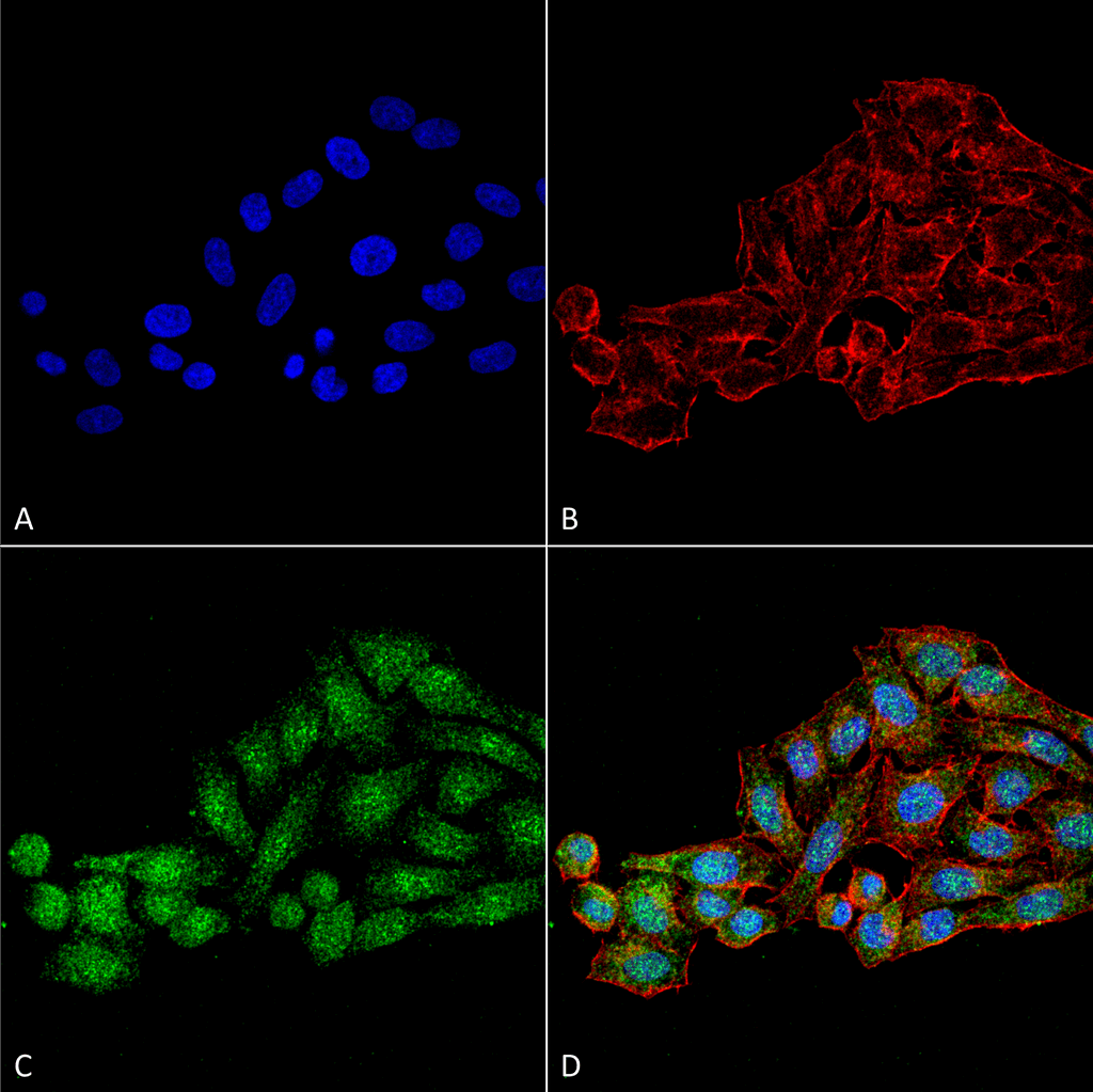 <p>Immunocytochemistry/Immunofluorescence analysis using Rabbit Anti-WDR45 Polyclonal Antibody (SPC-651). Tissue: Cervical cancer cell line (HeLa). Species: Human. Fixation: 4% Formaldehyde for 15 min at RT. Primary Antibody: Rabbit Anti-WDR45 Polyclonal Antibody (SPC-651) at 1:100 for 60 min at RT. Secondary Antibody: Goat Anti-Rabbit ATTO 488 at 1:200 for 60 min at RT. Counterstain: Phalloidin Texas Red F-Actin stain; DAPI (blue) nuclear stain at 1:1000, 1:5000 for 60 min at RT, 5 min at RT. Localization: Cytoplasm . Magnification: 60X. (A) DAPI (blue) nuclear stain (B) Phalloidin Texas Red F-Actin stain (C) WDR45 Antibody (D) Composite.</p>
