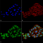 SPC-651_WDR45_Antibody_ICC-IF_Human_HeLa-Cells-Human-Cervical-Cancer_60X_Composite_1.png