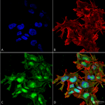 SPC-652-ATG2A-Antibody-ICC-IF-Human-Neuroblastoma-cell-line-SK-N-BE-60X-Composite-1.png