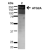 Rabbit Anti-ATG2A Antibody used in Western blot (WB) on Cervical cancer cell line (HeLa) lysate (SPC-652)