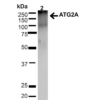 Rabbit Anti-ATG2A Antibody used in Western blot (WB) on Brain (SPC-652)