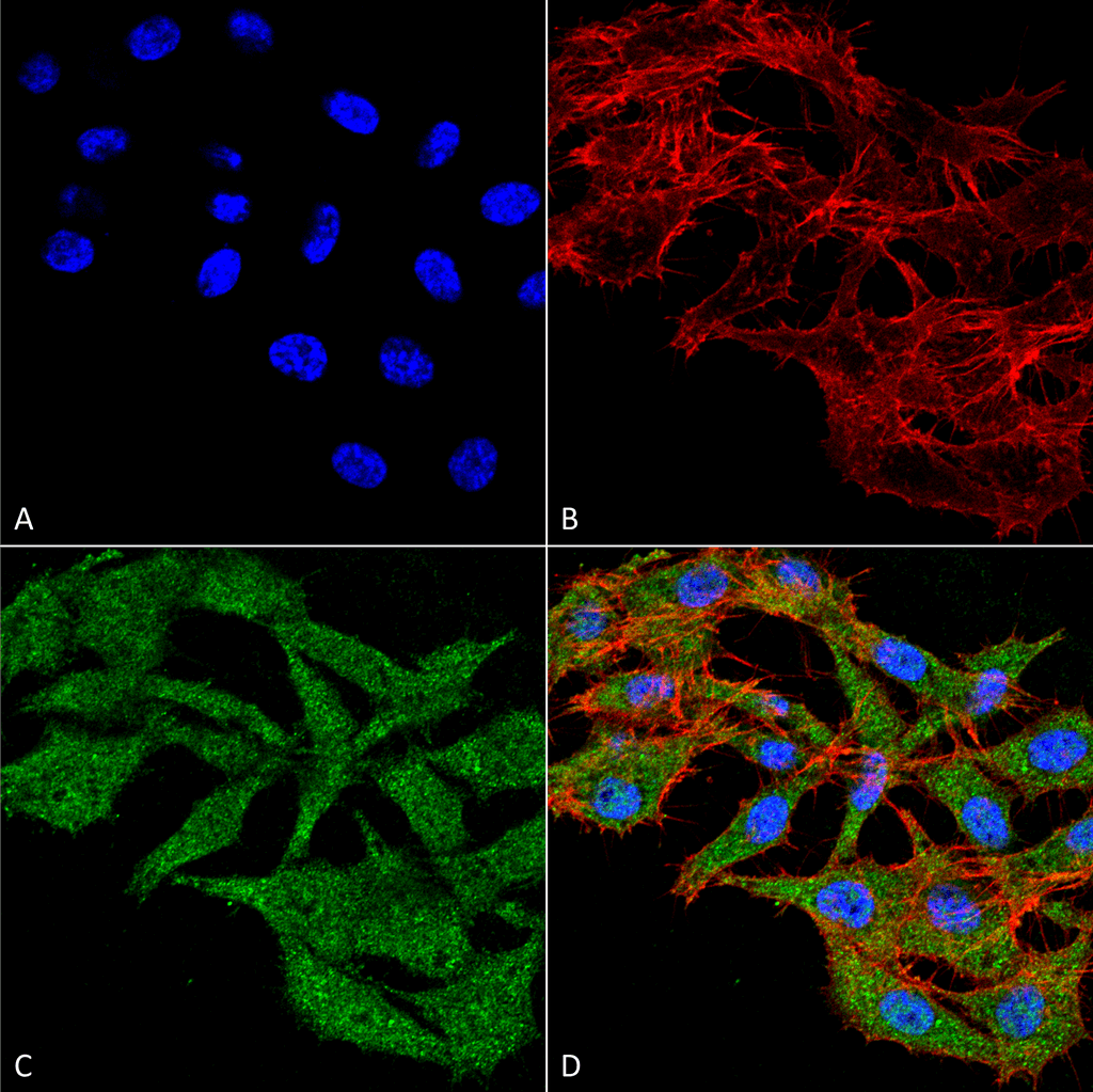 <p>Immunocytochemistry/Immunofluorescence analysis using Rabbit Anti-WDFY3 Polyclonal Antibody (SPC-666). Tissue: Colon carcinoma cell line (RKO). Species: Human. Fixation: 4% Formaldehyde for 15 min at RT. Primary Antibody: Rabbit Anti-WDFY3 Polyclonal Antibody (SPC-666) at 1:100 for 60 min at RT. Secondary Antibody: Goat Anti-Rabbit ATTO 488 at 1:100 for 60 min at RT. Counterstain: Phalloidin Texas Red F-Actin stain; DAPI (blue) nuclear stain at 1:1000, 1:5000 for 60 min at RT, 5 min at RT. Localization: Cytoplasm, Nucleus, Membrane. Magnification: 60X. (A) DAPI nuclear stain. (B) Phalloidin Texas Red F-Actin stain. (C) WDFY3 Antibody. (D) Composite.</p>
