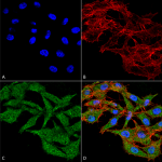 SPC-666_WDFY3_Antibody_ICC-IF_Human_Colon-carcinoma-cell-line-RKO_60X_Composite_1.png