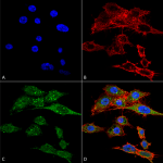 SPC-668_Rubicon_Antibody_ICC-IF_Human_Colon-carcinoma-cell-line-RKO_60X_Composite_1.png