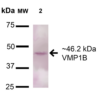 Rabbit Anti-VMP1 Antibody used in Western blot (WB) on A549 (SPC-680)