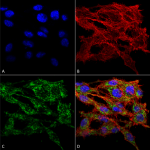 SPC-680_VMP1_Antibody_ICC-IF_Human_Colon-carcinoma-cell-line-RKO_60X_Composite_1.png