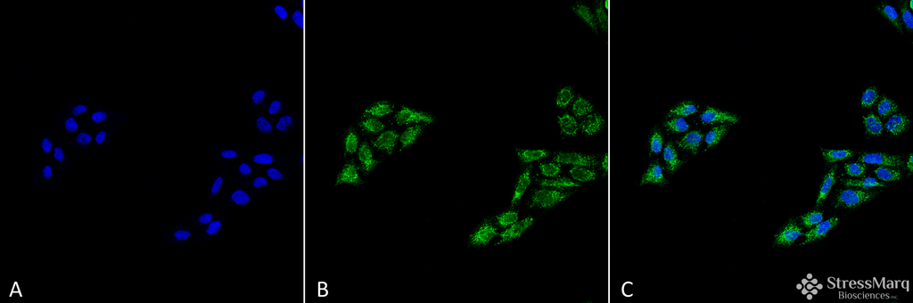 <p>Immunocytochemistry/Immunofluorescence analysis using Rabbit Anti-p53 Polyclonal Antibody (SPC-682). Tissue: Cervical cancer cell line (HeLa). Species: Human. Fixation: 4% Formaldehyde for 15 min at RT. Primary Antibody: Rabbit Anti-p53 Polyclonal Antibody (SPC-682) at 1:100 for 60 min at RT. Secondary Antibody: Goat Anti-Rabbit ATTO 488 at 1:100 for 60 min at RT. Counterstain: DAPI (blue) nuclear stain at 1:5000 for 5 min RT. Localization: Cytoplasm, PML body, Endoplasmic Reticulum. Magnification: 40X. (A) DAPI (blue) nuclear stain (B) Phalloidin Texas Red F-Actin stain (C) p53 Antibody (D) Composite.</p>
