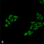SPC-682-p53-Antibody-ICC-IF-Human-Cervical-Cancer-cell-line-HeLa-40X-Composite-1.png