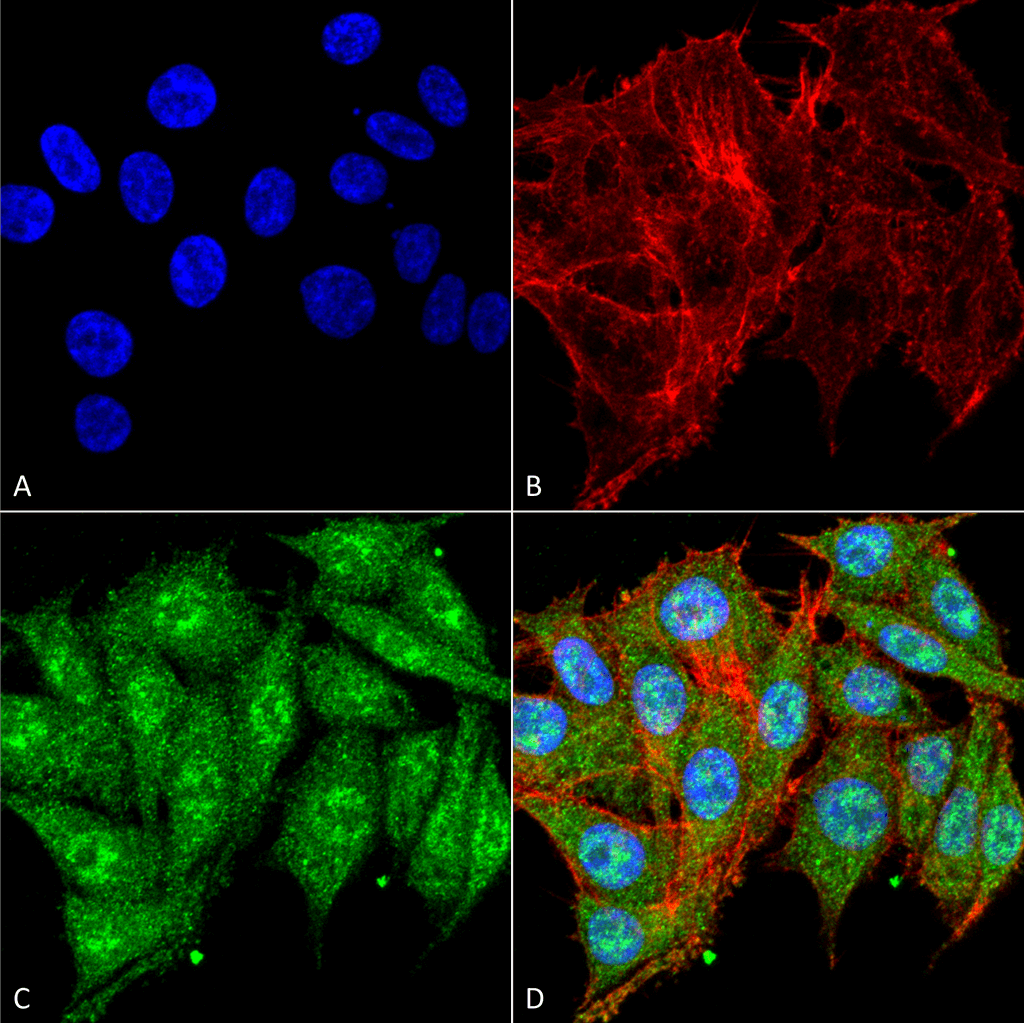 <p>Immunocytochemistry/Immunofluorescence analysis using Rabbit Anti-IGF-1 Polyclonal Antibody (SPC-699). Tissue: Colon carcinoma cell line (RKO). Species: Human. Fixation: 4% Formaldehyde for 15 min at RT. Primary Antibody: Rabbit Anti-IGF-1 Polyclonal Antibody (SPC-699) at 1:100 for 60 min at RT. Secondary Antibody: Goat Anti-Rabbit ATTO 488 at 1:100 for 60 min at RT. Counterstain: Phalloidin Texas Red F-Actin stain; DAPI (blue) nuclear stain at 1:1000, 1:5000 for 60 min at RT, 5 min at RT. Localization: Cytoplasm. Magnification: 60X. (A) DAPI nuclear stain. (B) Phalloidin Texas Red F-Actin stain. (C) IGF-1 Antibody. (D) Composite.</p>
